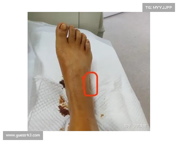 小基恩脚踝受伤缺席训练，皮奥有望国家队首发